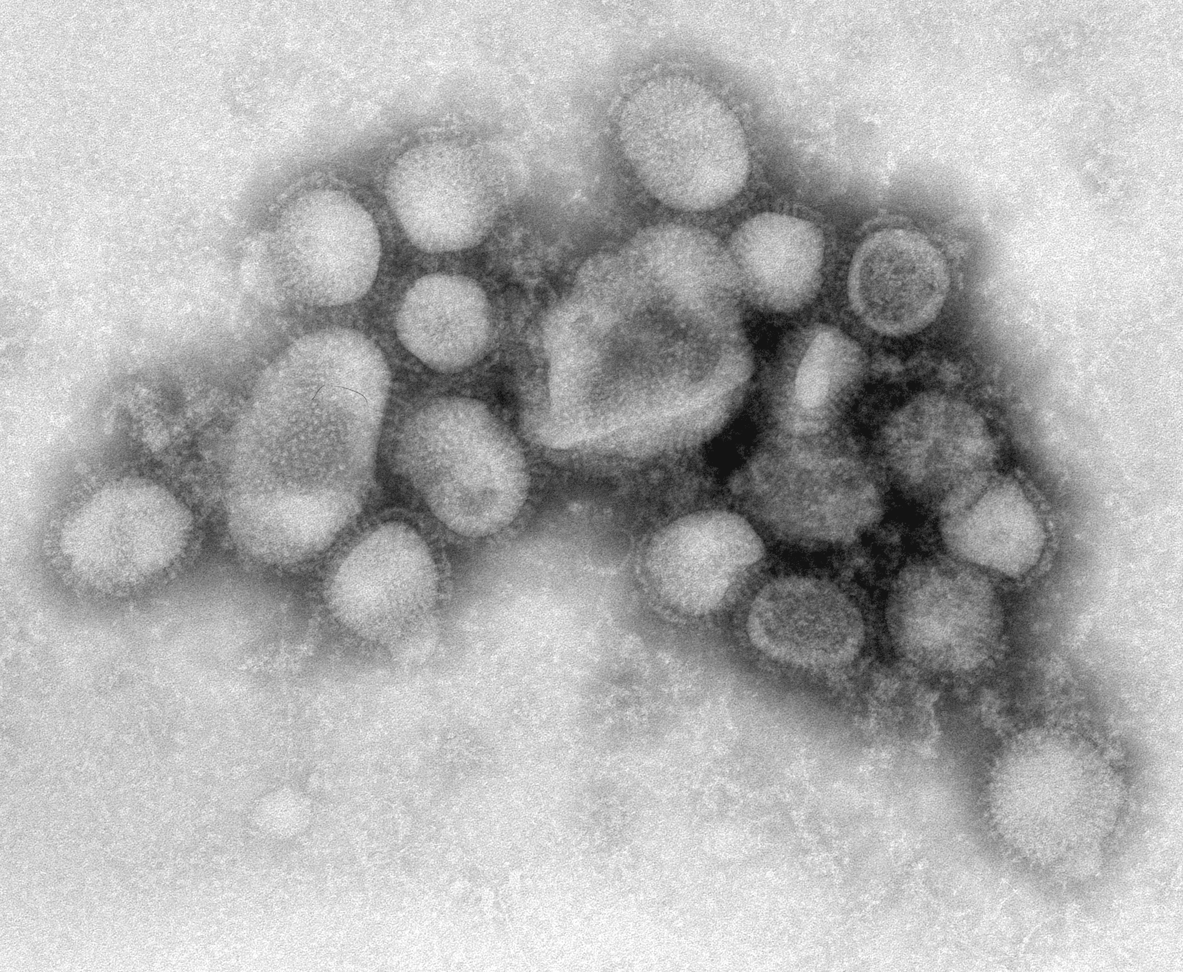 Archival electron micrograph of influenza A(H1N1) virus particles, made by CDC scientists in 2009.
